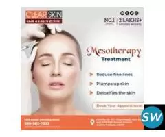 Laser Treatment For Birthmark Removal In India