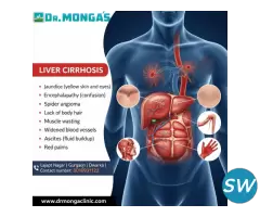Best Liver Cirrhosis Treatment Hospital in India