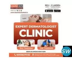 Best Advance Syringoma Treatment in india