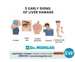 Grade 2 fatty infiltration of liver - 1