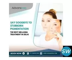 The Best Melasma Treatment in Delhi