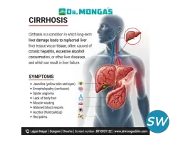 Liver Cirrhosis Stages and Symptoms - 1