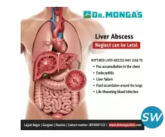Liver Abscess Signs and Symptoms - 1