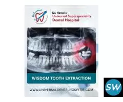 Wisdom Tooth Extraction - 1