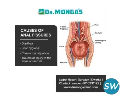 Best Treatment for Fistula 8010931122 - 1