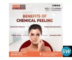 Stretch Marks  Laser  Treatment in India - 1