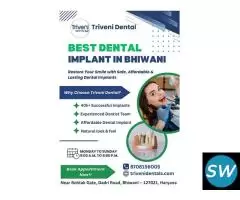Best Dental Implant in Bhiwani | Triveni Dental