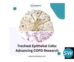 Tracheal Epithelial Cells: Advancing COPD Research