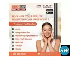 Best Advance Syringoma Treatment in india