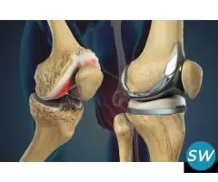 Orthopedic Expert in Jaipur’s Vaishali Nagar