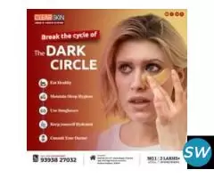 Laser Treatment For Birthmark Removal In India