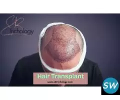 Find the Right Clinic | Hair Transplant in Gurgaon