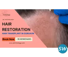 Choose Wisely Before Your Hair Restoration Journey