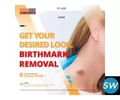 Pulse dye laser treatment in india