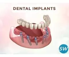 Best Dentists in Langar House | FMS Dental