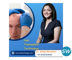 Advanced Hair Transplant Technique | FUE, FUT