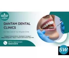 Best Dental Clinic in Hyderabad - DANTAM CLINICS
