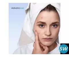 Best Treatment for Pigmentation on Face