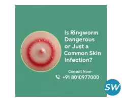 Is Ringworm Dangerous ?