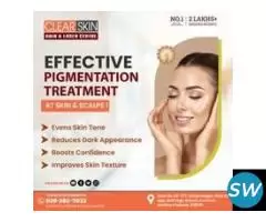 Best Advanced Xanthelasma Treatment in india