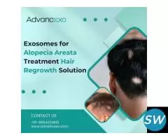 Exosomes for Alopecia Areata Treatment