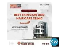 Best Advance Syringoma Treatment in india