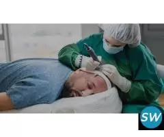 Affordable Hair Transplant Cost in Delhi NCR