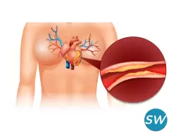 CT Coronary Angiography Price Know