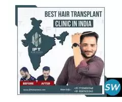 best hair transplant clinic in Jaipur