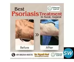 SRIMAYAM AYURVED - Psoriasis treatment in Surat