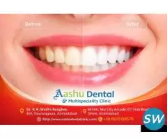 Restore Your Smile with Full Mouth Rehabilitation