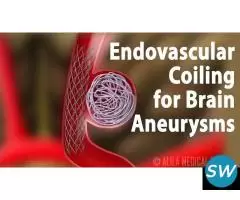 Endovascular Coiling for Brain Aneurysm