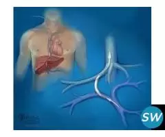 Safe and Effective TIPS Shunt Procedure