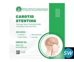 Carotid Angioplasty with Stent for Artery Disease