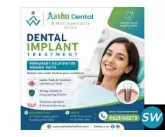 Dental Implants Treatment Ahmedabad