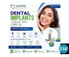 Dental Implants Ahmadabad - Jahnavee Dental