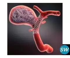 Aneurysm Coiling | Brain Care