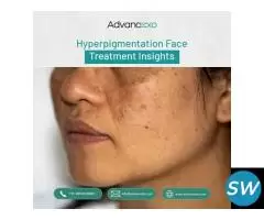 Hyperpigmentation Face Treatment Insights