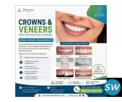 Top-Rated Crowns and Veneers Clinic Ahmadabad