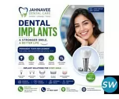 Best Dental Implants in Ahmadabad | Jahnavee