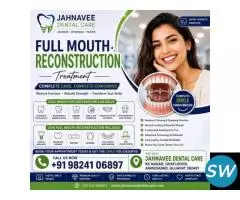 Full Mouth Reconstruction Treatment in Ahmadabad