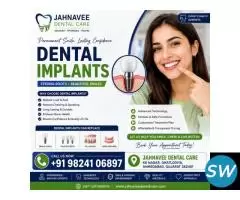 Dental Implants in Ahmadabad by Expert Dentists