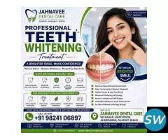 Teeth Whitening treatment in Ahmadabad