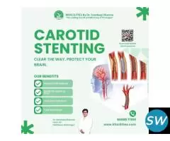 Carotid Stent – Minimally Invasive Treatment