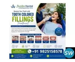Expert Tooth Colored Fillings Treatment