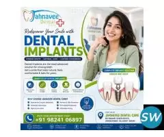 Best Dental Implants Clinic in Ahmadabad