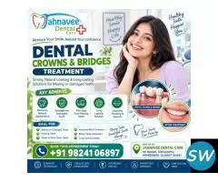 Dental Crowns and Bridges Treatment