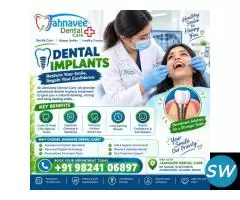 Dental Implants in Ghatlodiya – Dental Care