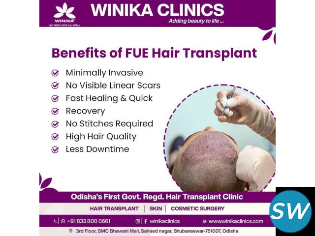 Best Hair Transplantation Clinic - 1