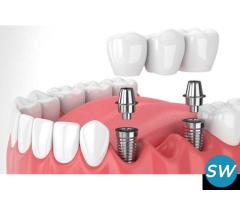 Dental Implants in Whitefield-Dental Implants Surgery - 2